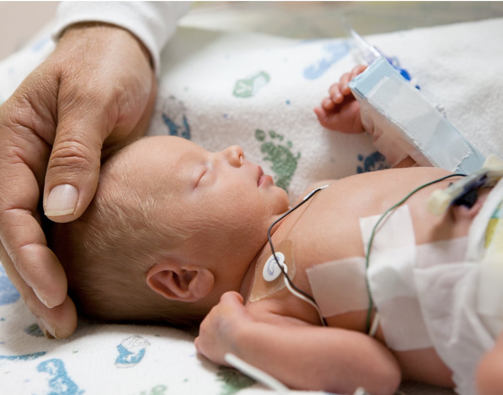 A healthcare professional's hand gently touching the head of a sleeping newborn baby in the Neonatal Intensive Care Unit (NICU)